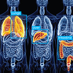 Medical Image Annotation