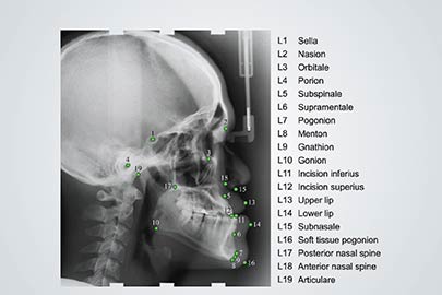 Landmark Annotation