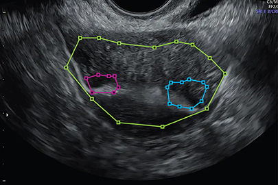 Polylines Annotation